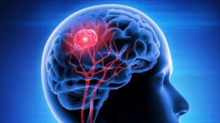 മസ്തിഷ്കത്തിൽ അമീബയും ഫങ്കസും ബാധിച്ച കുട്ടിയെ ചികിത്സിച്ച് രക്ഷപ്പെടുത്തി